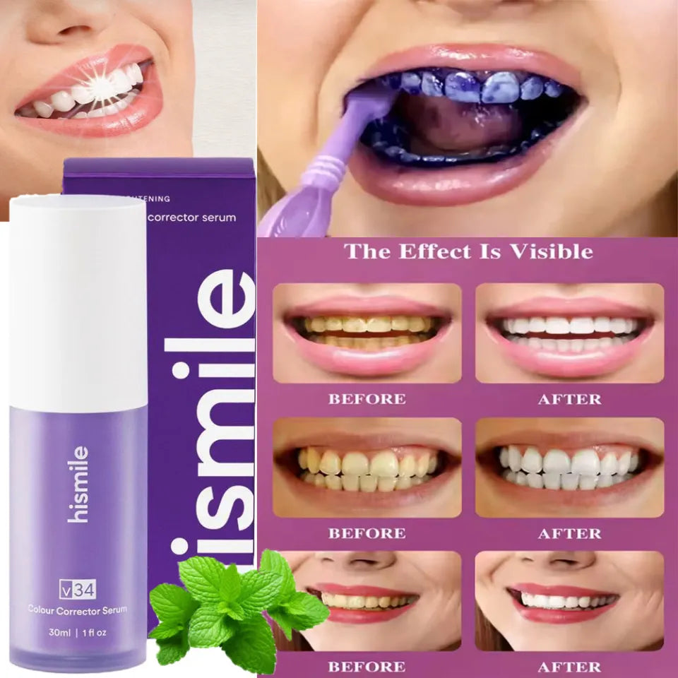 Hismile V34 Colour Corrector - Instant Teeth whitening 30 ML